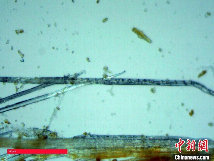 显微样品A显微观察(1000倍)。　重庆市文物考古研究院 供图