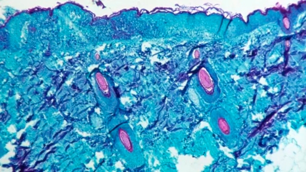 显微镜下看到的猴痘病毒（图源：美国疾病控制与预防中心）