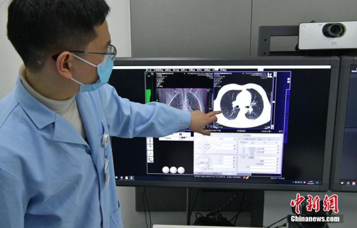 资料图：四川成都，医生通过患者肺部CT影像讨论患者病情。<a target='_blank' href='/'>中新社</a>记者 刘忠俊 摄