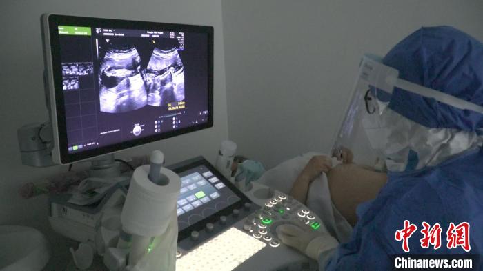 风险区孕妇在成都妇女儿童中心医院接受产检。　吕杨 摄