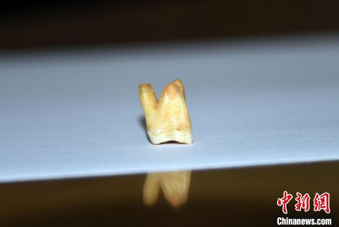 你会的剔牙，这群古人类8-12万年前就会了