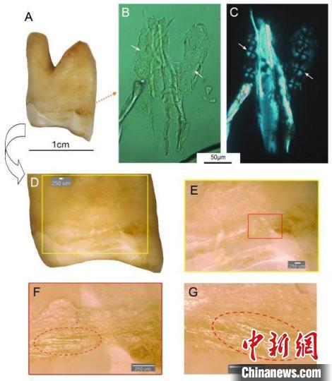 湖南道县福岩洞8-12万年前古人类剔牙行为的遗存痕迹。　吴妍 供图